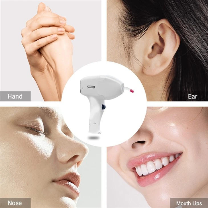 Israel Laser Hair Removal Machine