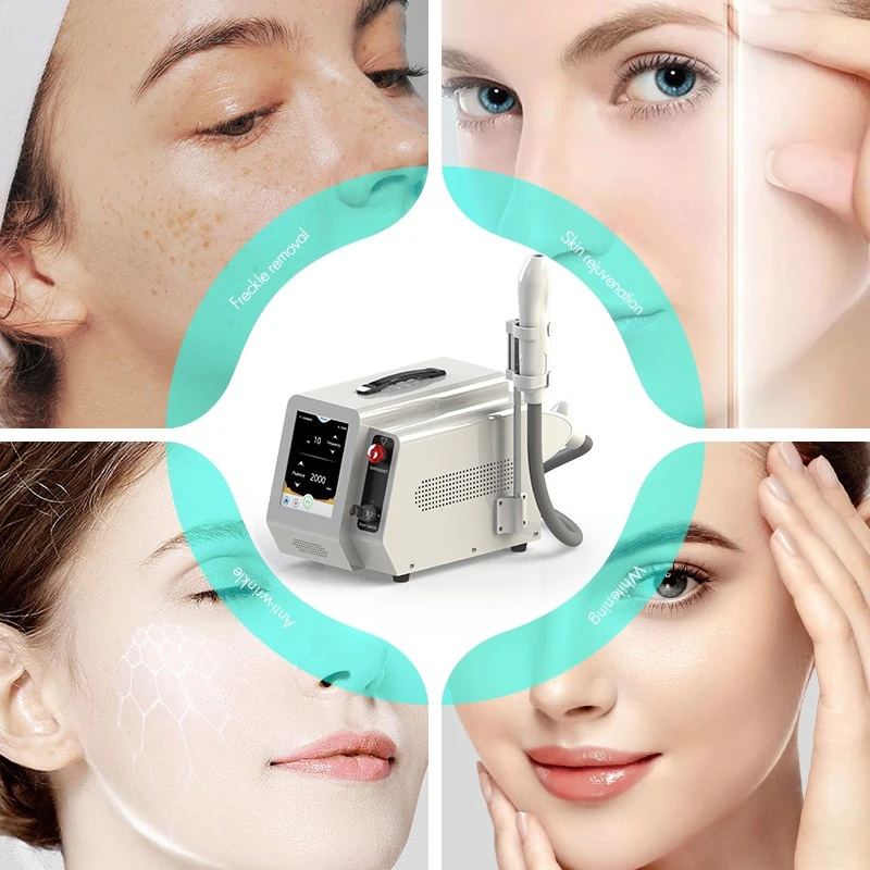New ND YAG Laser Tattoo Removal Machine suppliers