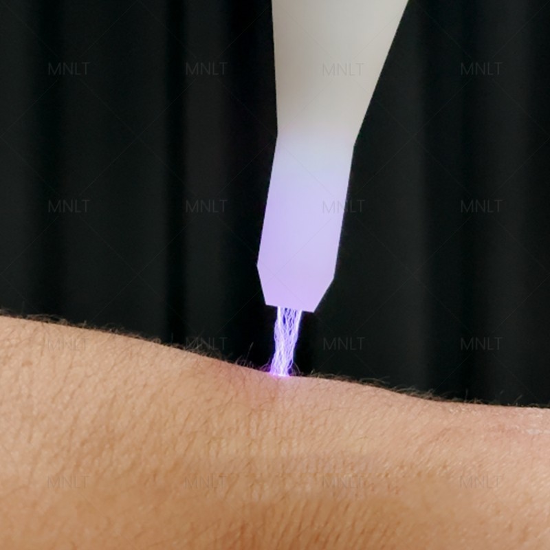Newest Fractional Cold Plasma suppliers